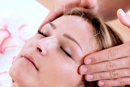 acupuncture skin rejuvenation 3