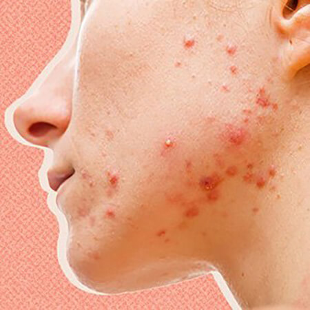 https://dl.greenbeautymag.com/2021/10/effect-hormones1-skin2.jpg