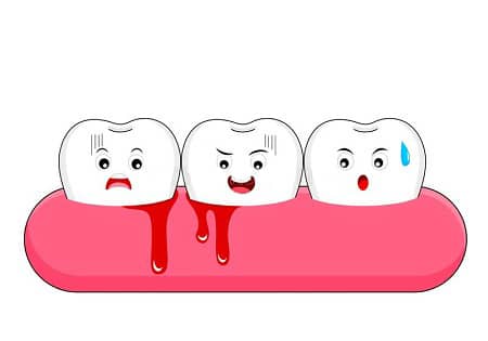 علت خونریزی لثه های شما + قطع فوری خونریزی دندان