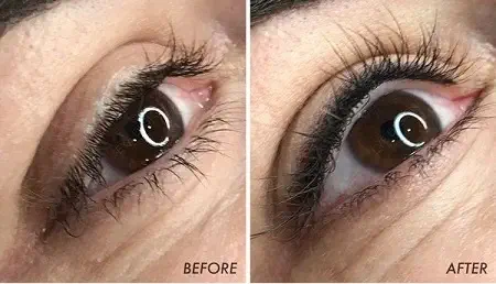 راههای کاهش و عوارض التهاب چشم بعد از تاتو خط چشم