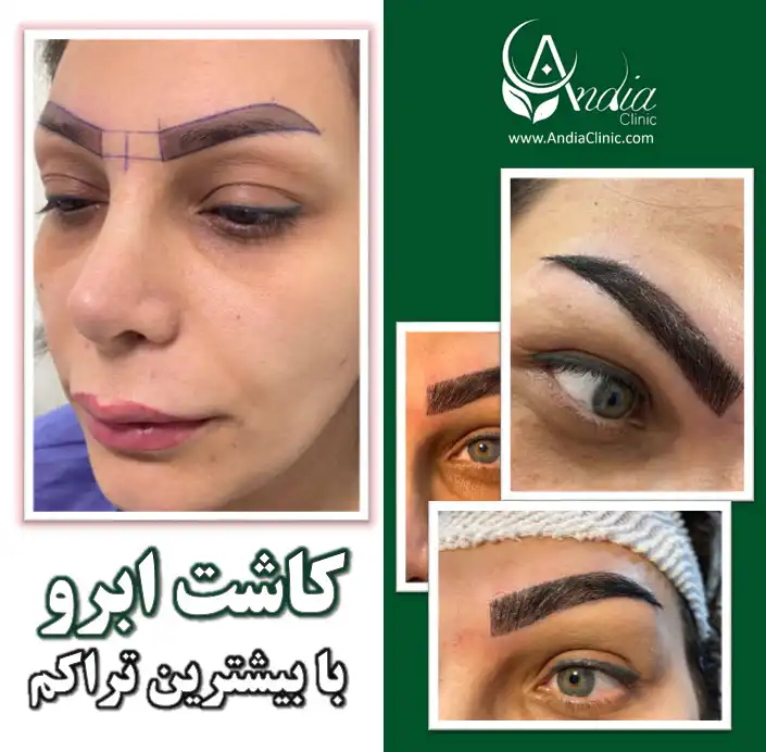 https://dl.greenbeautymag.com/2024/07/cd59e9cd-f300-416e-b872-fee628a15e6a.webp