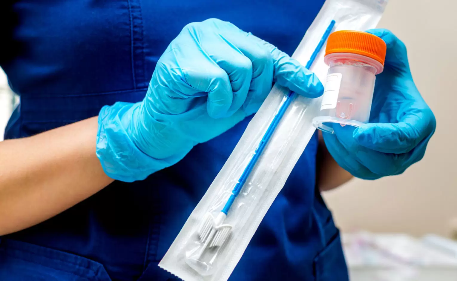 بررسی آزمایش ویروس پاپیلومای انسانی (hrHPV)