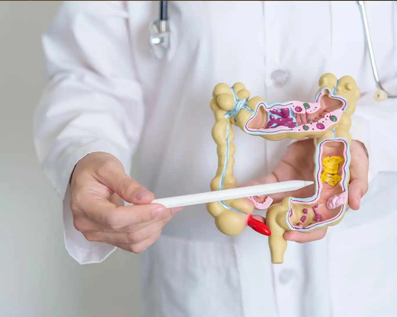 هفت نشانه اولیه سرطان روده بزرگ هفت نشانه اولیه سرطان روده بزرگ