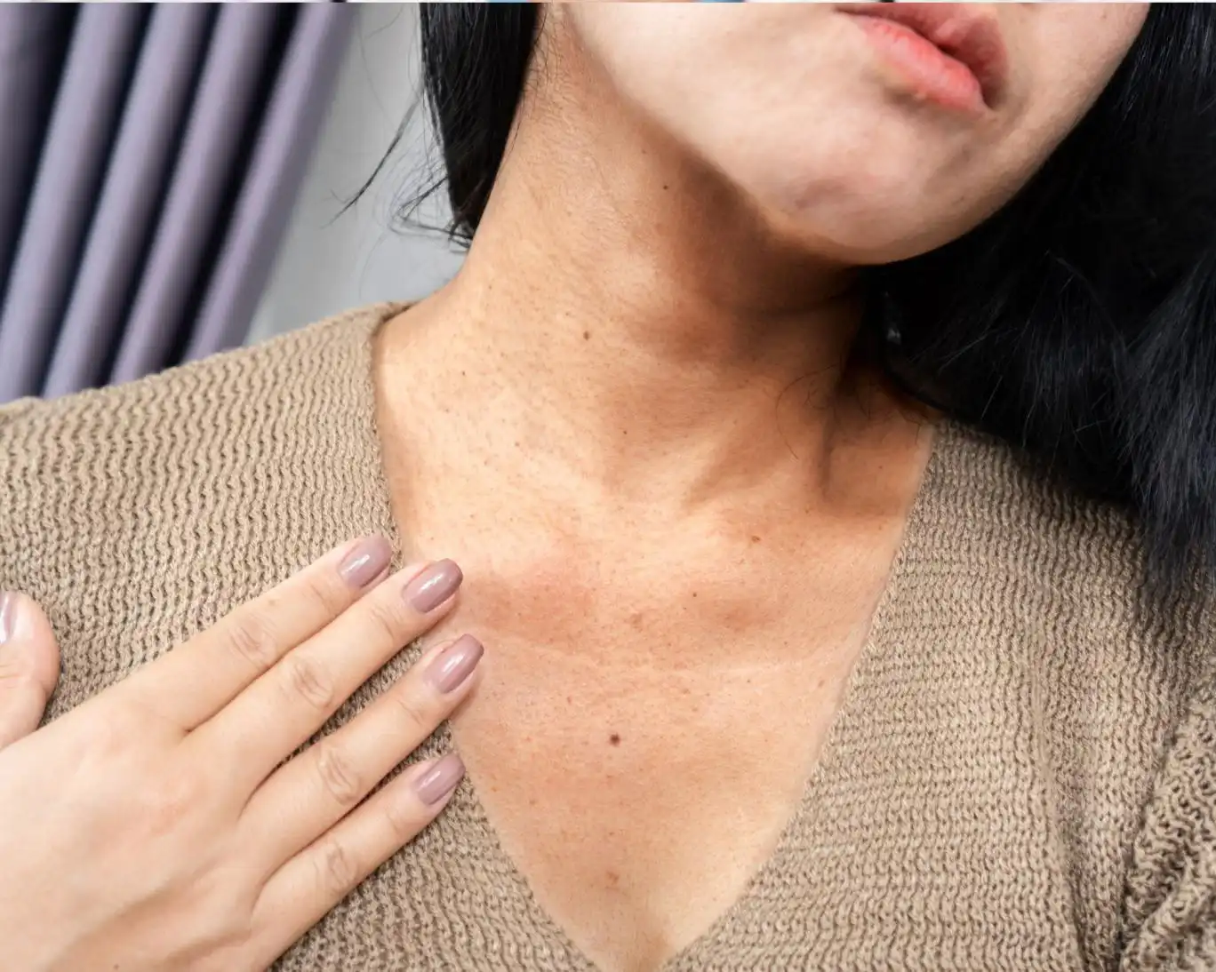 تغییر پوستی که میتواند نشانه قند خون بالا باشد تغییر پوستی که میتواند نشانه قند خون بالا باشد